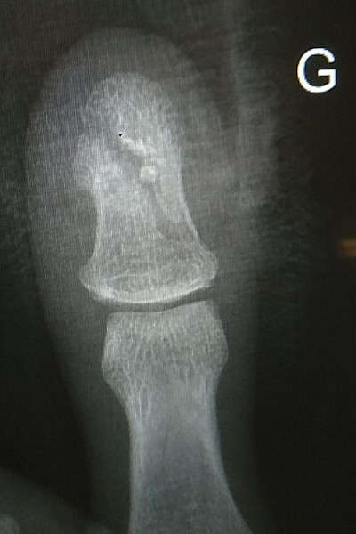 Première radio, du dessus