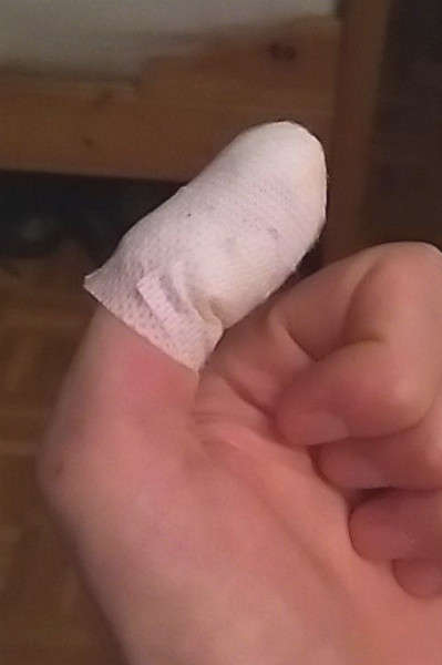 L'articulation en flexion maximum