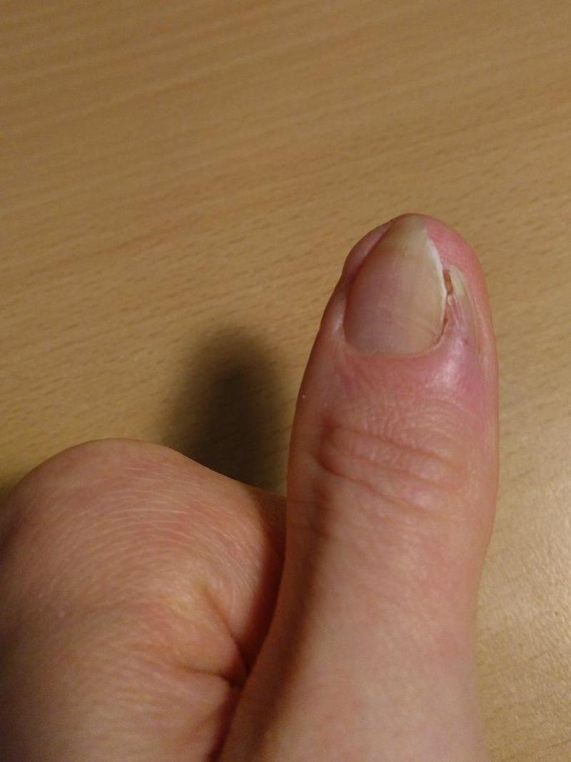 On voit la partie gauche de la repousse en bonne forme et la partie droite qui fait n'importe quoi