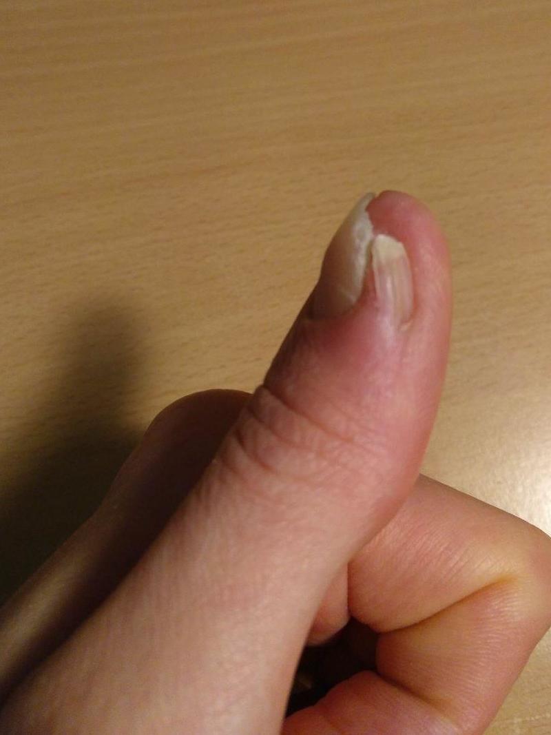 On voit la partie gauche de la repousse en bonne forme et la partie droite qui fait n'importe quoi